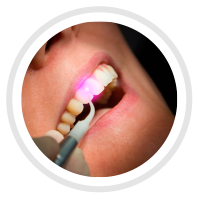 odontoiatria laser assistita