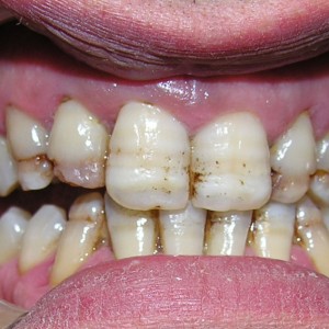 est avanzata 01 est avanzata 01