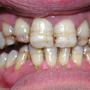 est avanzata 02 est avanzata 02