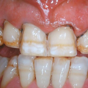 est avanzata 03 est avanzata 03