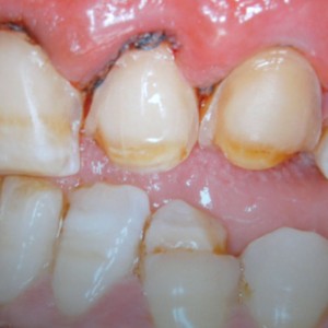 est avanzata 04 est avanzata 04