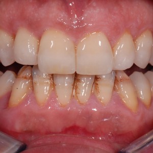 est avanzata 05 est avanzata 05