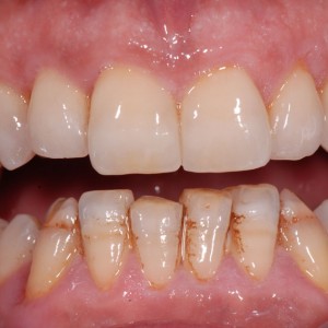 est avanzata 06 est avanzata 06