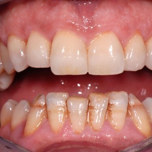 est avanzata 07 est avanzata 07